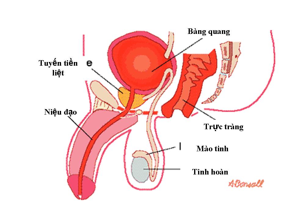 Nguyên nhân gây phì đại tuyến tiền liệt