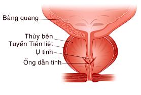 Cách phòng ngừa phì đại tuyến tiền tiệt