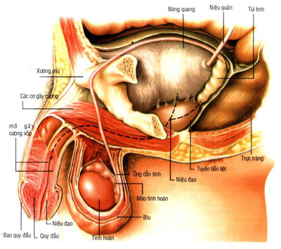 Biến chứng của viêm bàng quang